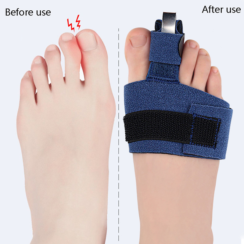 1Pcs Toe Corrector Toe Fractur - Ankle Brace Sock ulasan dan harga
